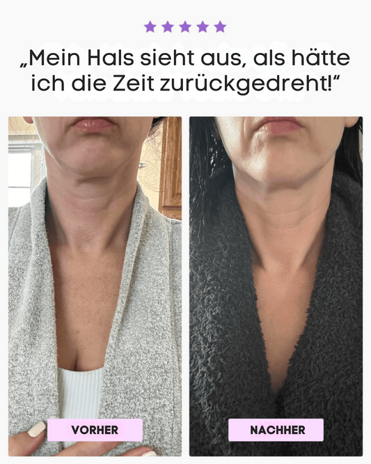 FIRMAÉ Tighten & Lift Halscreme