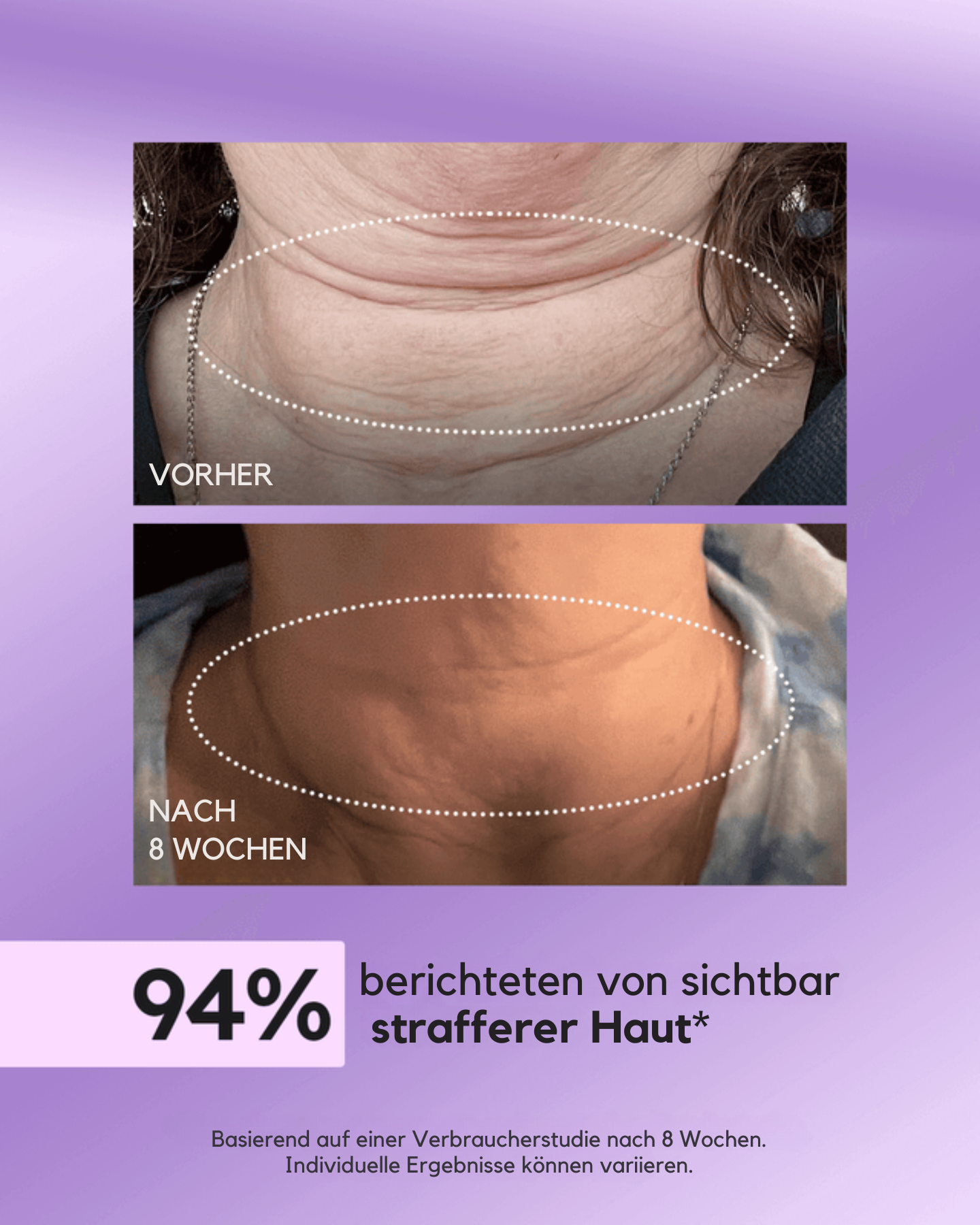 FIRMAÉ Tighten & Lift Halscreme