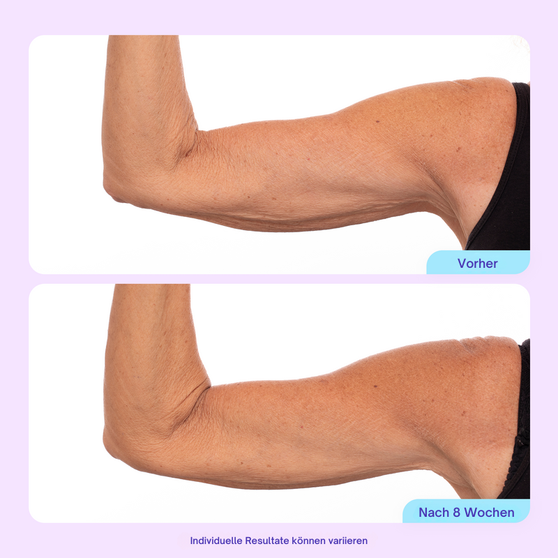 Sculpt & Tone Armcreme