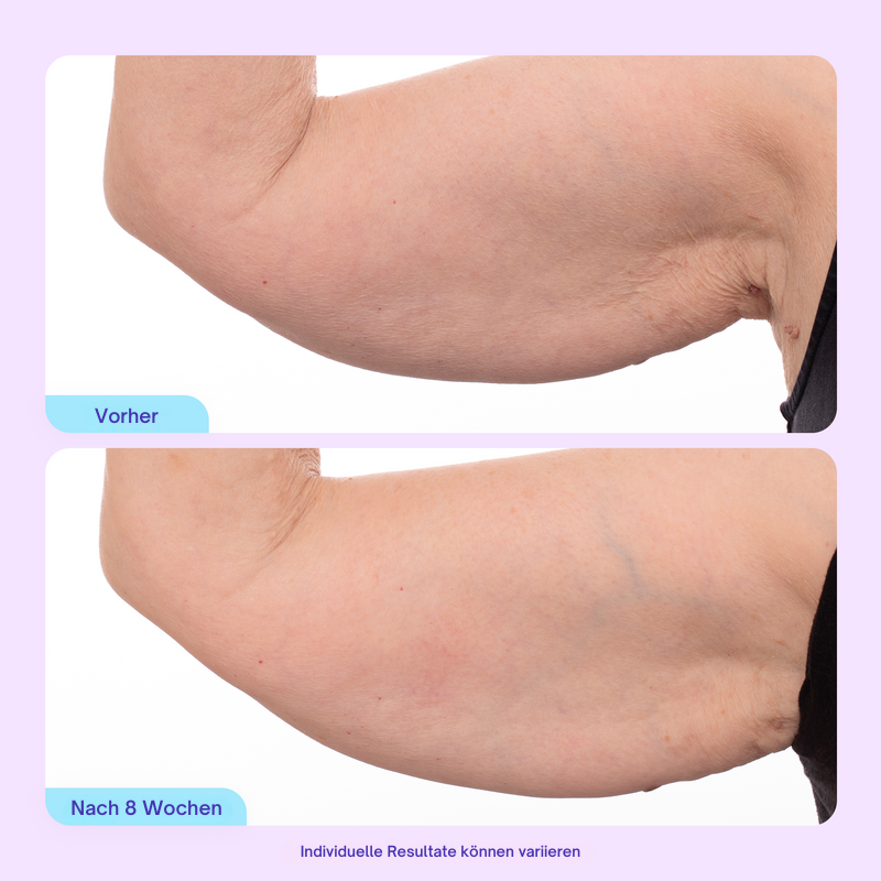 Sculpt & Tone Armcreme